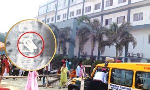 खेल्दाखेल्दै बालकले निले कैँची, डाक्टरले निकाले