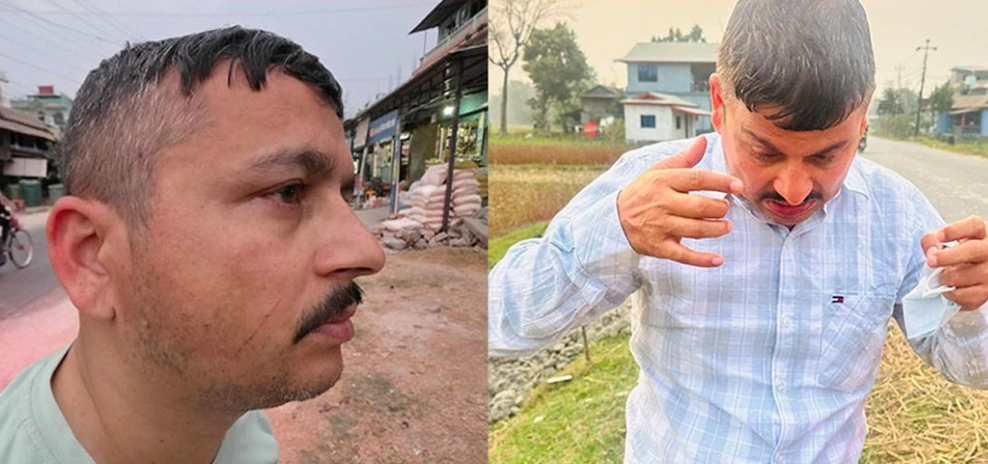 झापामा पत्रकार अर्जुन आचार्यमाथि एमाले कार्यकर्ताद्वारा आक्रमण